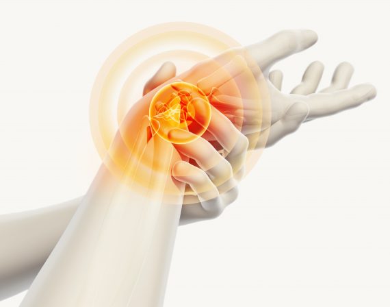 3D Animation von einem Schmerzendem Handgelenk